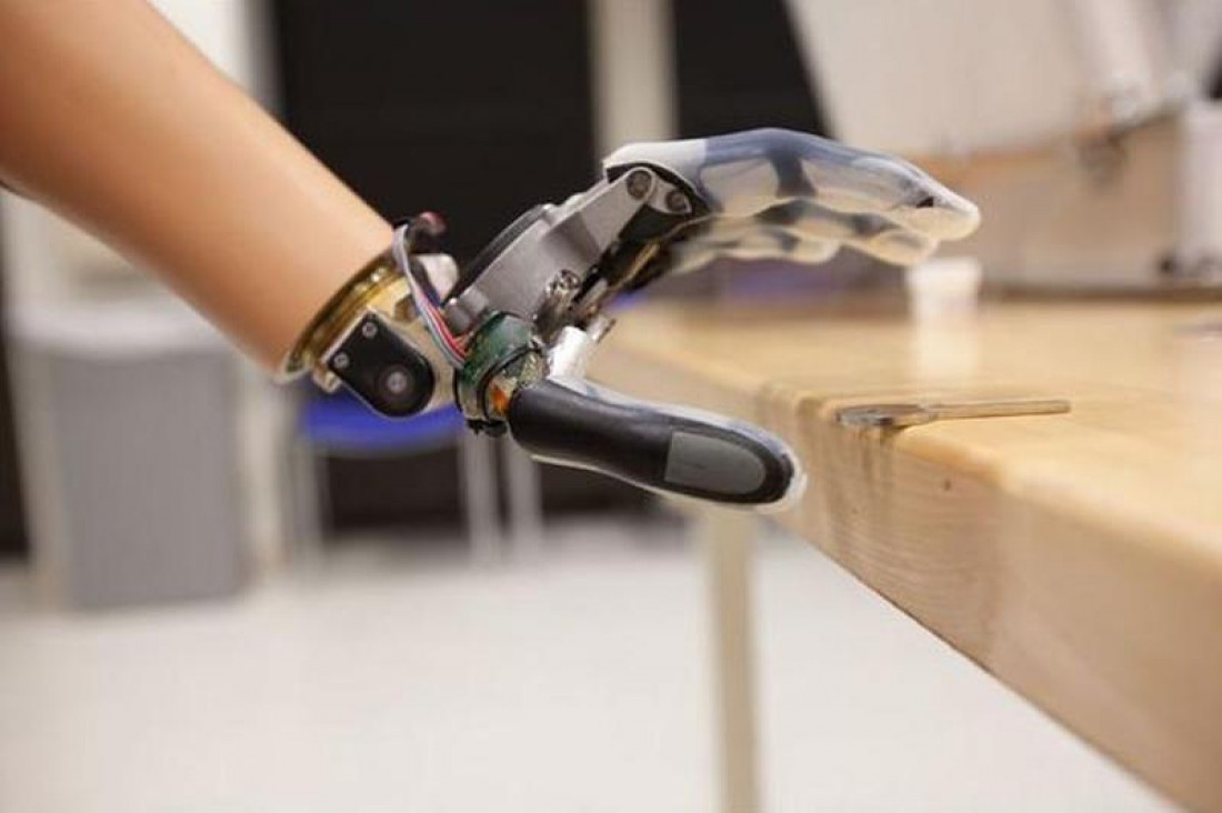 Биоадаптивная рука SmartHand израильского ученого Йоси Шахам-Диаманда