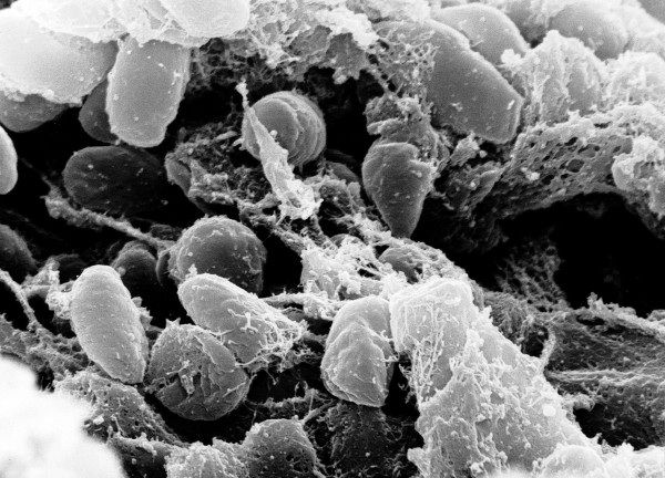 Причина бубонной чумы, бактерии Yersinia pestis , под микроскопом