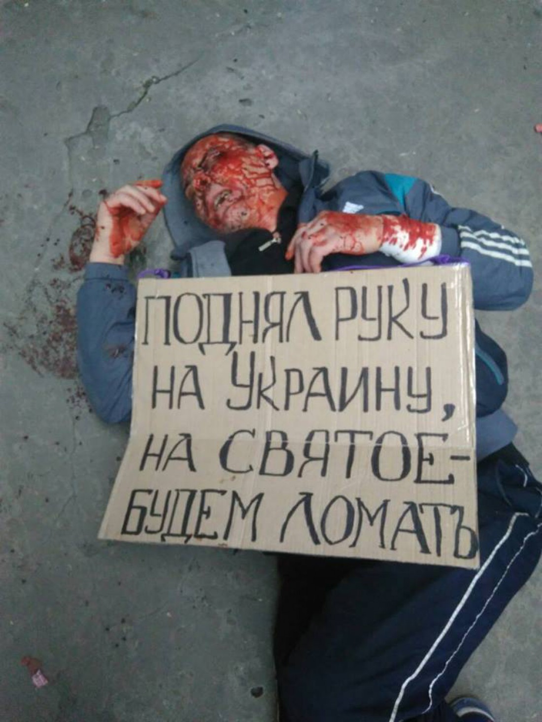 Избитого человека оставили лежать с такой табличкой