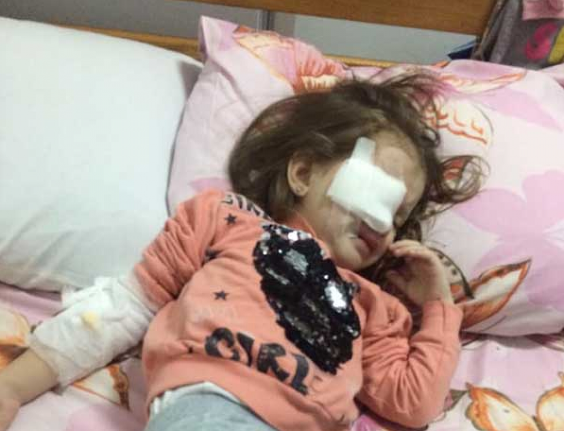Воспитательница даже не упомянула родителям, что был удар карандашом