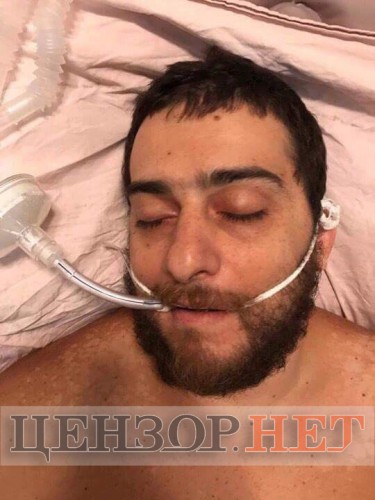 Еще один раненый из группы нападавших в больнице Мечникова
