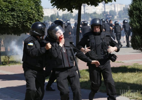 На Марше равенства милиционер получил тяжелое ранение в шею