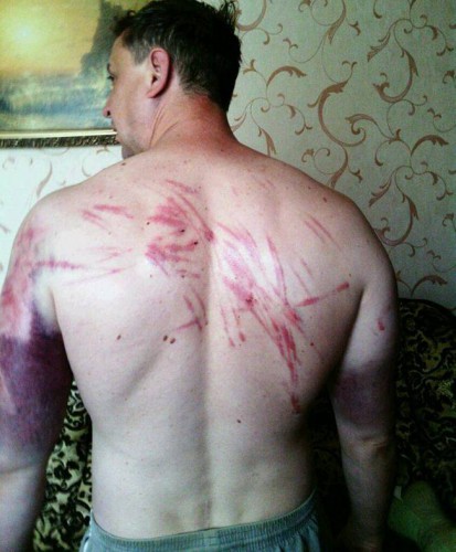 Сергей Косяк после пыток в штабе боевиков ДНР