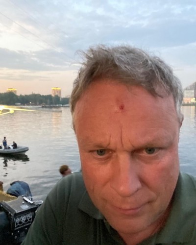 Жигунов сообщил, что ранение он получил в День ВМФ