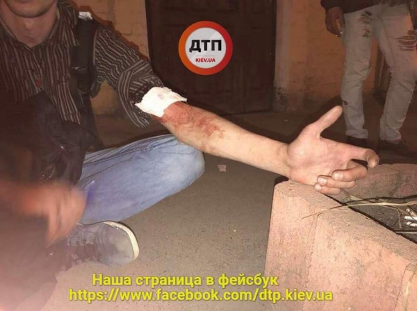 Пострадавший в драке
