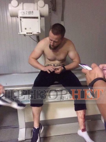 В больницу привезли четверых из группы нападавших, СМИ показали фото троих