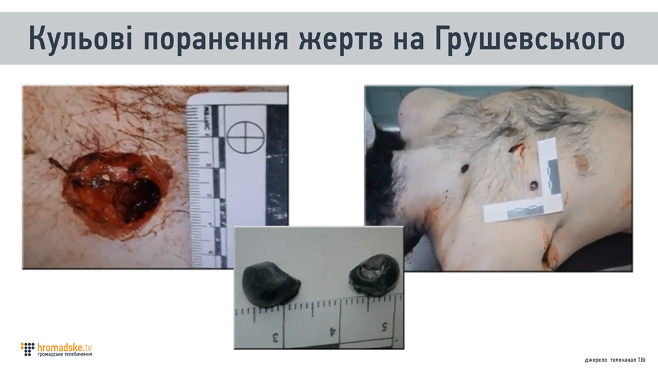 Пули, изъятые из тел убитых