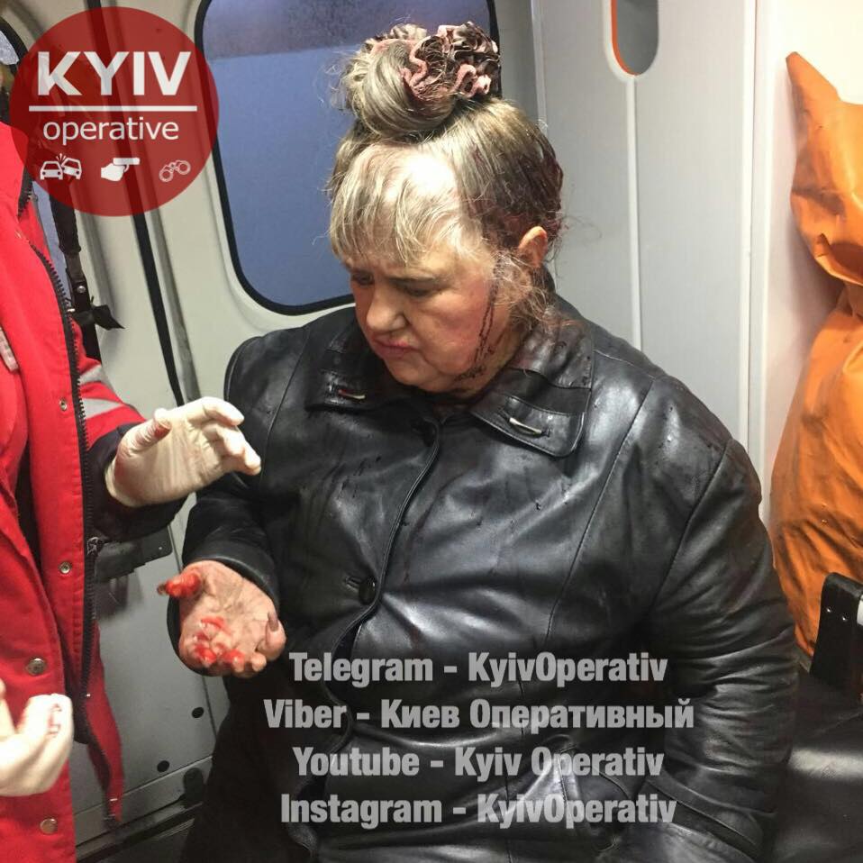 Женщина с разбитой головой потеряла память