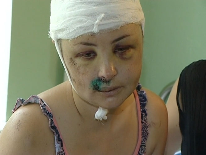 Ирина Крашкова в больнице после операции
