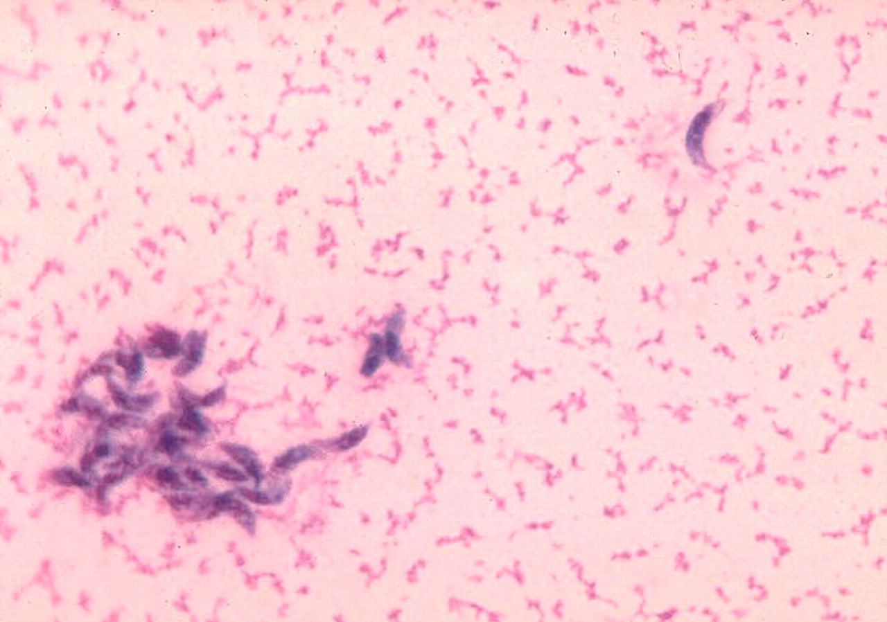Toxoplasma gondii под микроскопом