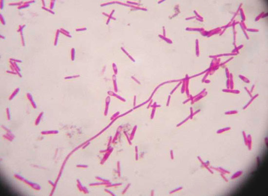 Бактерия Clostridium Botulinum