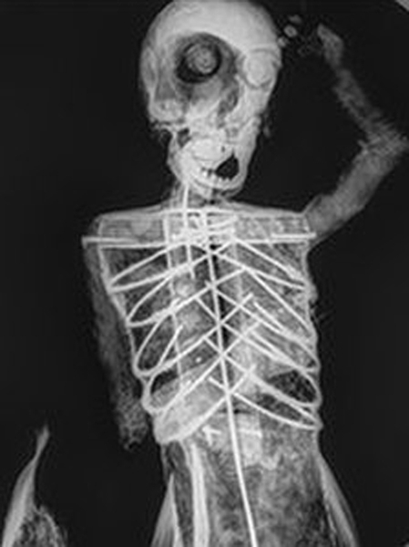 Ученые исследуют мумию русалки