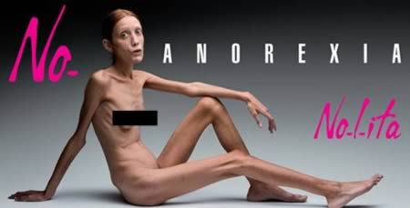 9 самых невероятных случаев анорексии