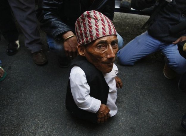 Самый маленький человек найден в непальской деревне