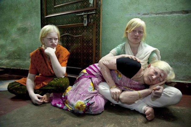 Самая большая семья альбиносов