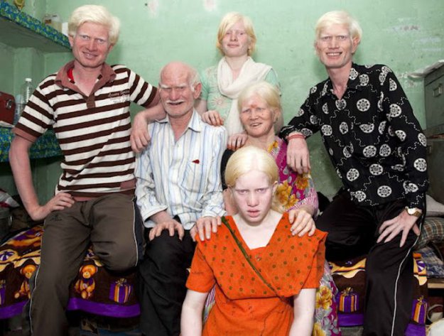 Самая большая семья альбиносов