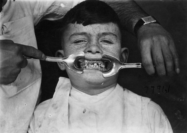 Жуткие стоматологические инструменты прошлых лет