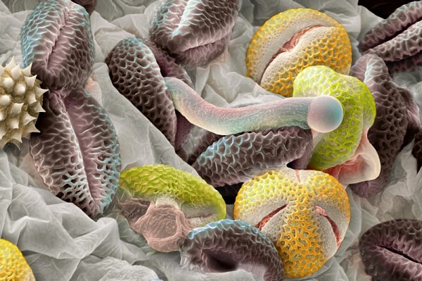 Пыльца растений под микроскопом.