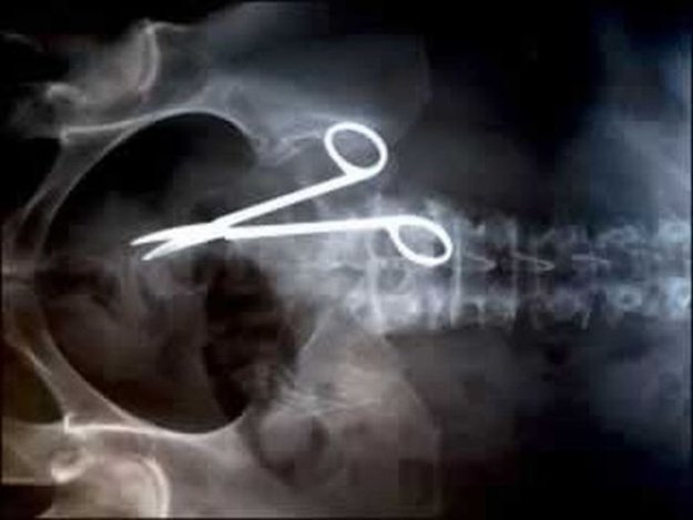 Необычные снимки рентгена