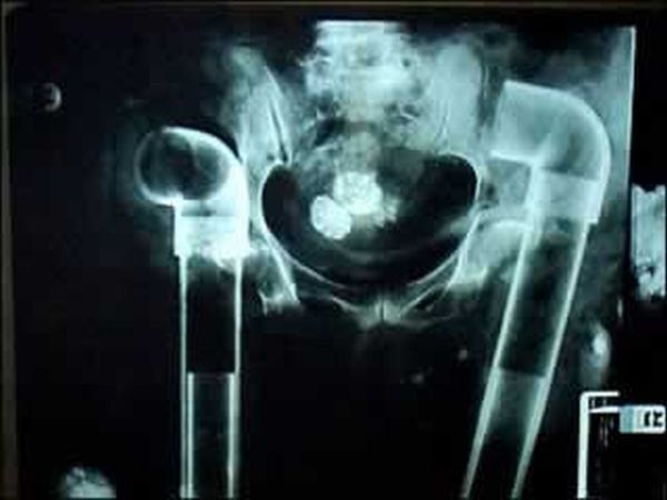 Необычные снимки рентгена