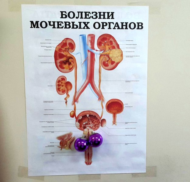 ����� �����... ))
