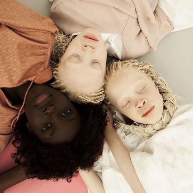 11-летние сестры-альбиносы покорили мир моды