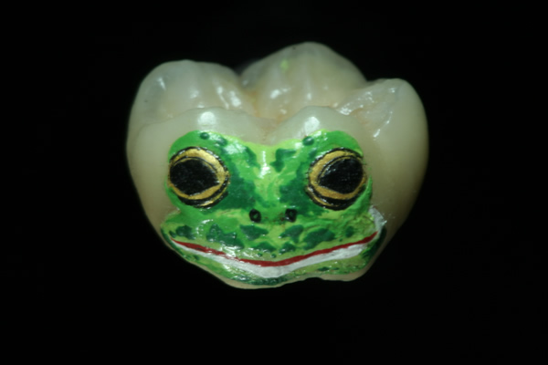 Dental Art - Tooth Tatoos