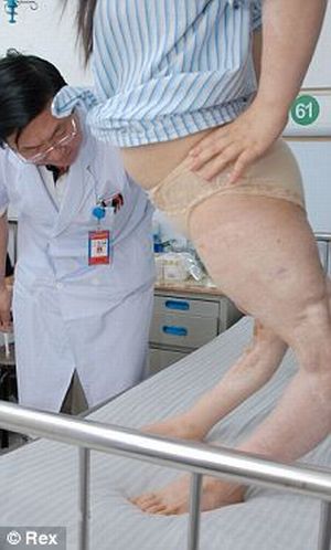 Китаянка с перекрученными ногами