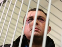Шепелеву сломали нос и челюсть, он едва говорит - Матиос