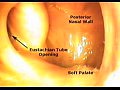 Anatomical Tutorial During Trans-Nasal Endoscopy